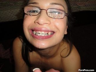 tube8 Teen Girls With Braces Facial